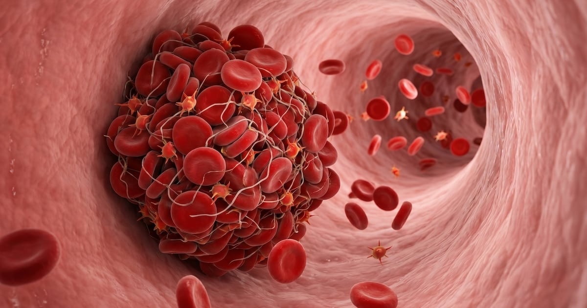 Cuando una pierna se queja: las señales que el cuerpo manda antes de un coágulo de sangre y por qué conviene no dejarlas pasar