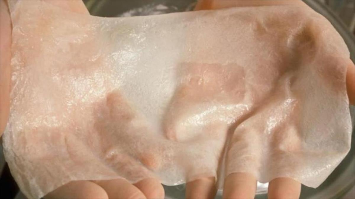 Piel artificial: la tecnología que redefine el tratamiento de quemaduras