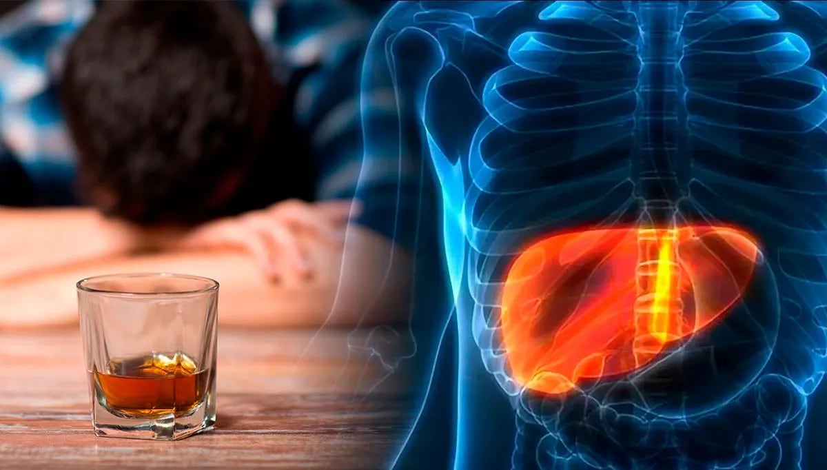 El exceso de alcohol limita la regeneración total del hígado, incluso al dejarlo