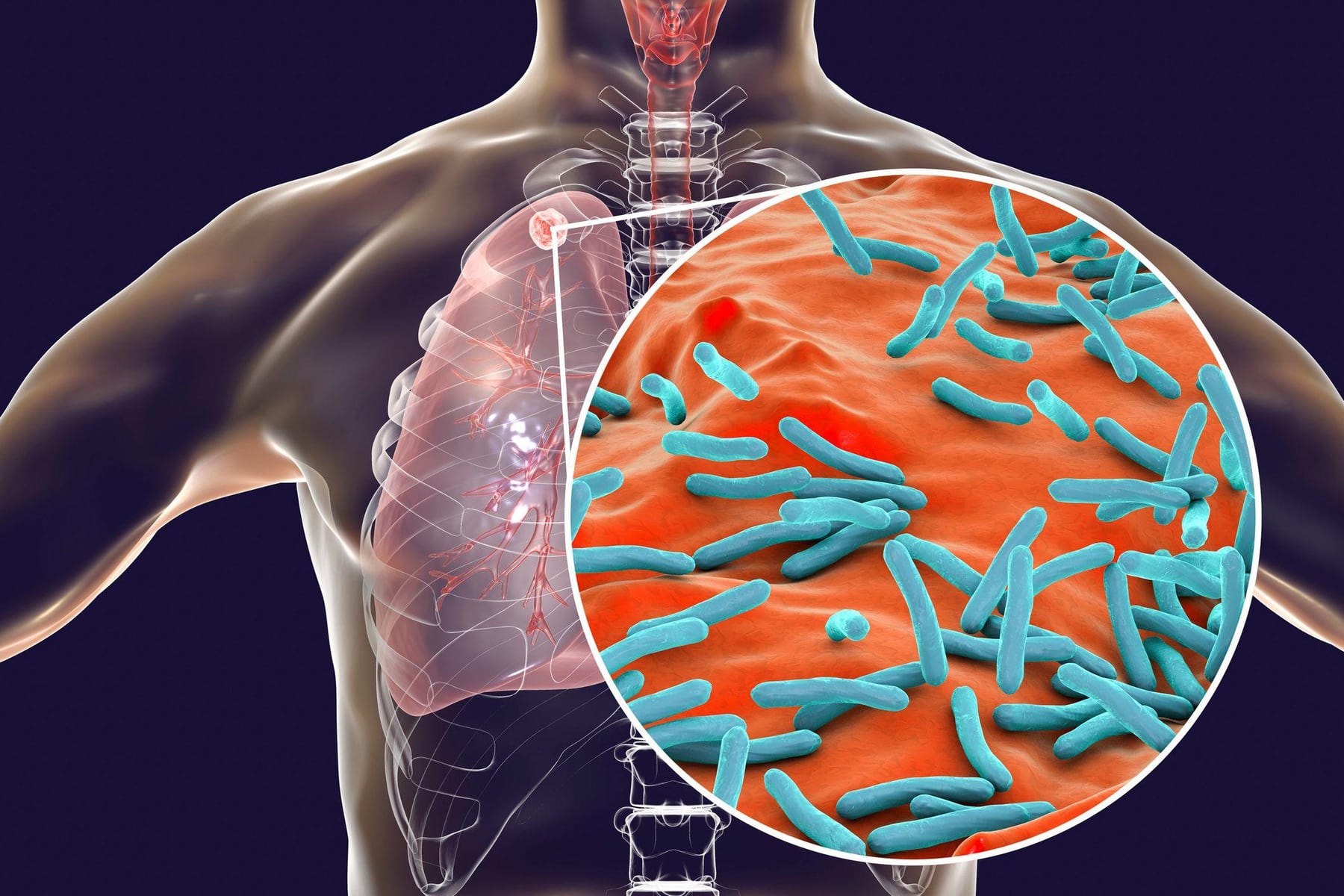 Científicos tardaron años en abordar el problema de superbacterias; una IA lo solucionó en 48 horas