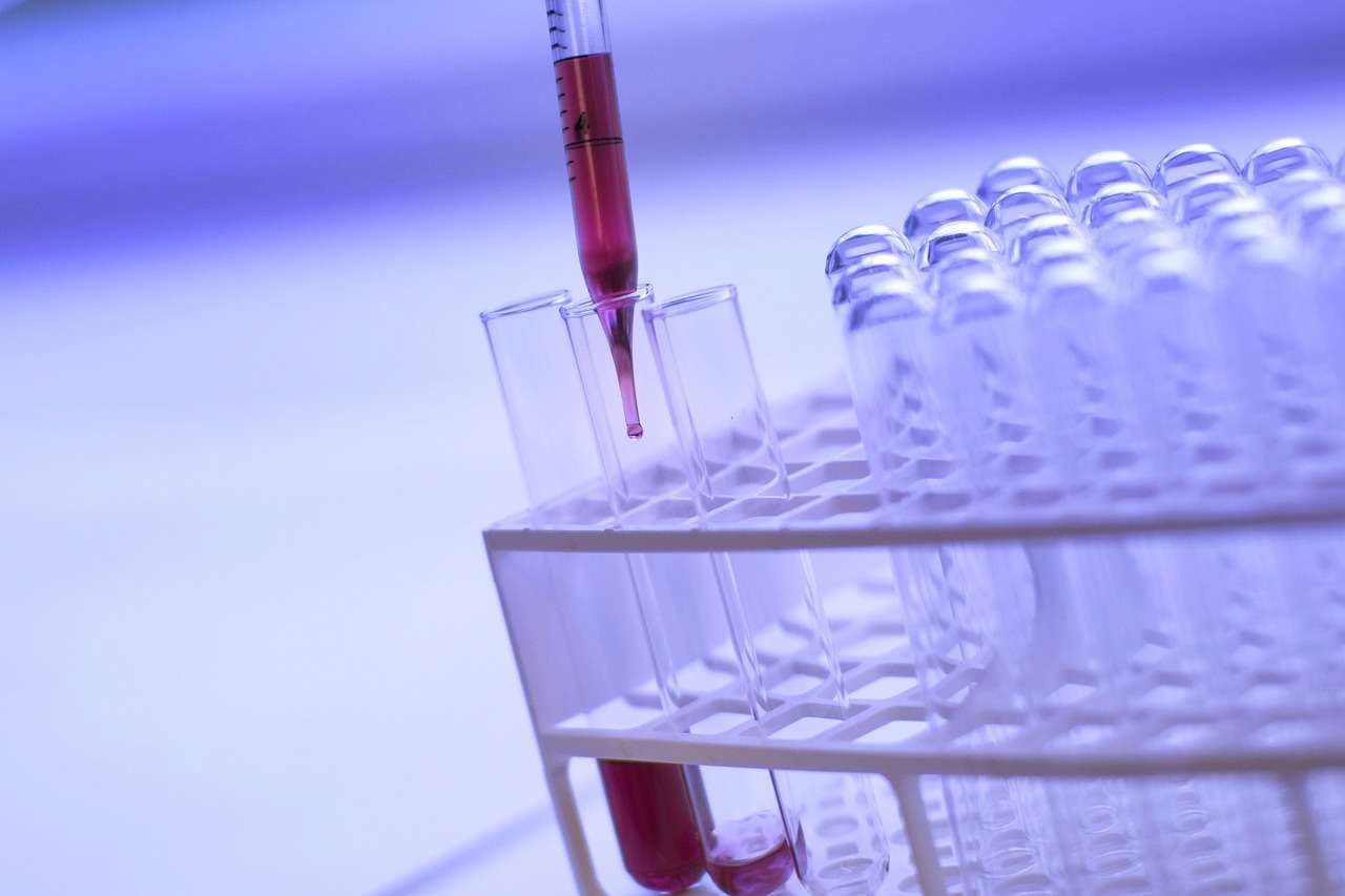 Prueba experimental logra detectar el Alzheimer con una efectividad superior al 90%